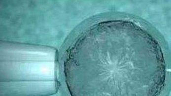 结节性硬化病患者能做试管避免遗传吗(第三代试管婴儿技术能不能避免鱼鳞病)